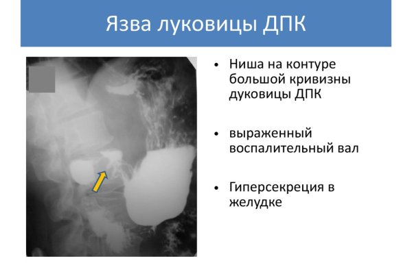 Kraken официальные зеркала